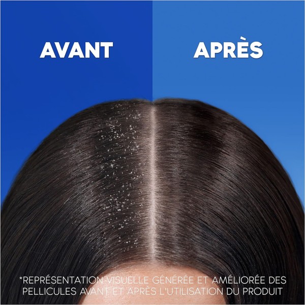 copy of HEAD & SHOULDERS Shampoing DERMAxPRO Antipelliculaire Revitalise Expert Cuir Chevelu + Après-Shampoing (225 ml)