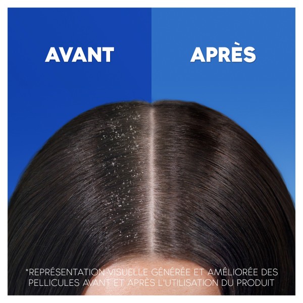 copy of HEAD & SHOULDERS Shampoing DERMAxPRO Antipelliculaire Revitalise Expert Cuir Chevelu + Après-Shampoing (225 ml)